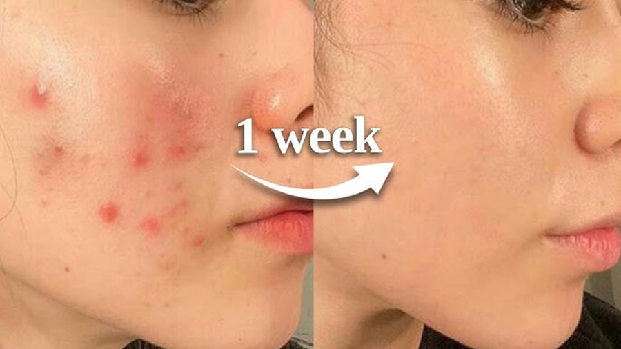 How to Exfoliate Without Damaging Your Skin Barrier