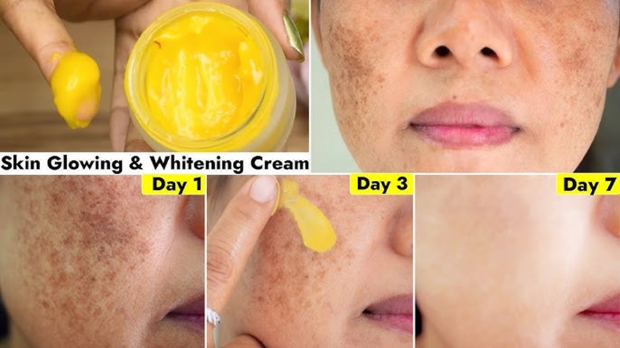 Can Face Cream Reduce Dark Spots