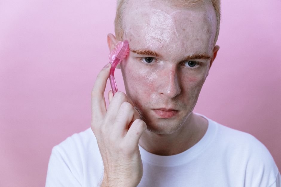 7 Best Ingredients for Acne-Prone Skin